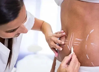 Total Body Contouring in India