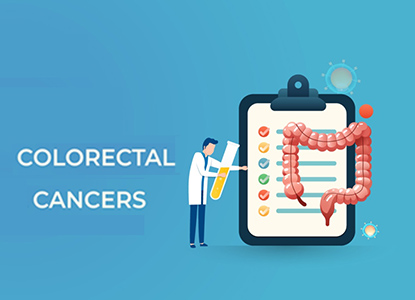 Professional Colon Cancer Management