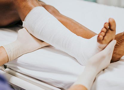 Post Fracture Stiffness Treatment in Lucknow