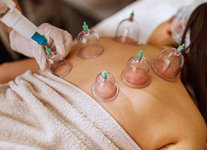 Cupping Therapy Treatment in Lucknow