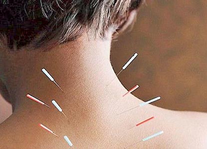 Dry Needling Treatment in Lucknow