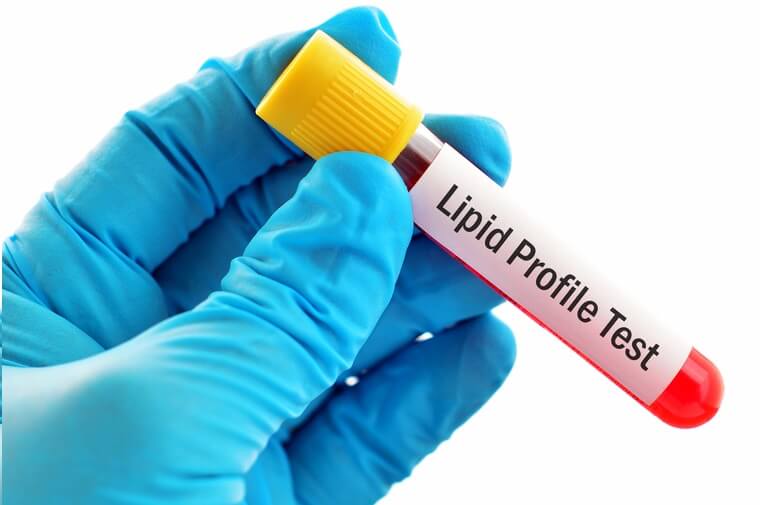 Lipid Profile - Extended