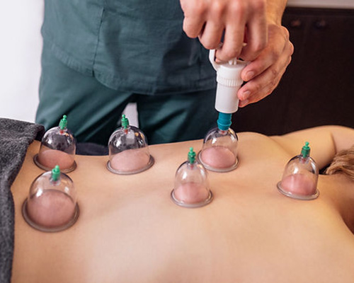 Cupping or Hijama Therapy in Nangloi West Delhi