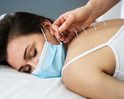Dry Needling Physiotherapy in Nangloi West Delhi